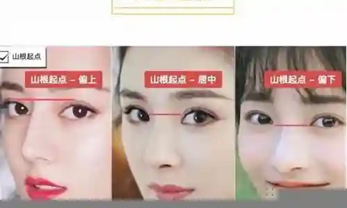 山根略低阵容插图