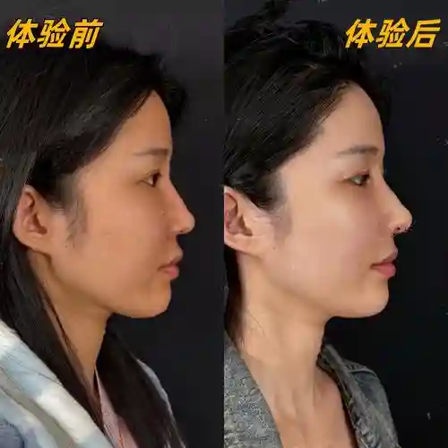 鼻子阵容对比_1插图1