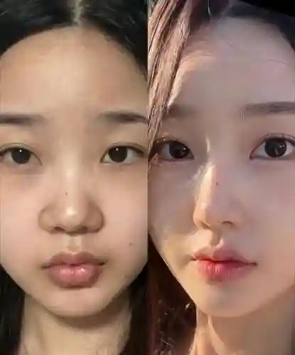鼻子阵容对比_1插图