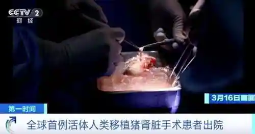 现在科技能移植什么器官插图1